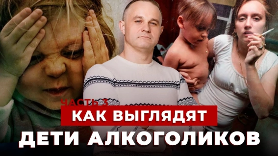 как выглядят дети алкоголиков
